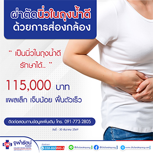ผ่าตัดนิ่วในถุงน้ำดีด้วยการส่องกล้อง Cholecystectomy