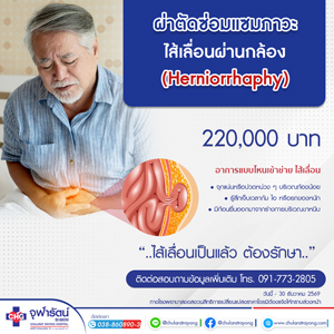 ผ่าตัดซ่อมแซมภาวะไส้เลื่อนผ่านกล้อง Herniorrhaphy